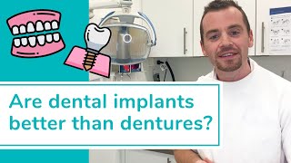 DENTAL IMPLANTS VS DENTURES Whats better [upl. by Innes181]