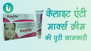 Kaylite Anti Marks Cream ke fayde labh upyog nuksan lagane ka sahi tarika uses review price [upl. by Ymerrej]