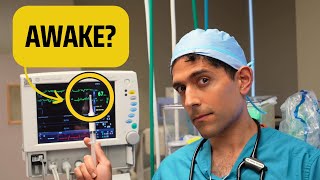 How To Tell If A Patient Is Awake Under Anesthesia And What To Do [upl. by Abas]