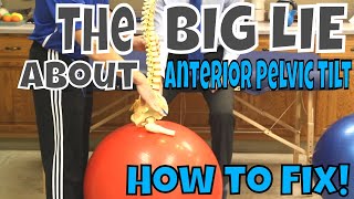 The BIG LIE About Anterior Pelvic Tilt How to Fix [upl. by Kinzer]