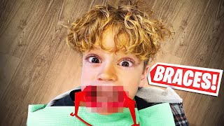 9 YEAR OLD GETTING BRACES ROWDYROGAN [upl. by Erroll484]