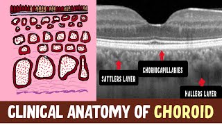 Anatomy Of Choroid  Hallers layer Sattlers layer Choriocapillaris and Clinical Nuggets [upl. by Ostraw504]