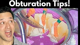 Root Canal Obturation Simplified  Tips to Save You Time [upl. by Yttam]