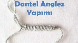 Dantel Anglez Yapımı [upl. by Ait]