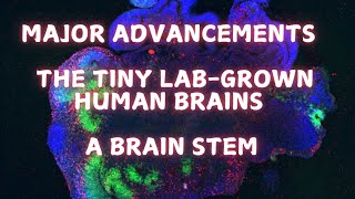 Giving the labgrown brains a brainstem [upl. by Neeuq]