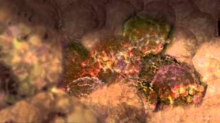 Cancer Cells Undergoing Mitosis [upl. by Odnumyer]