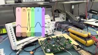 EEVblog 660  Electrocardiogram ECG Experiments [upl. by Torrence]