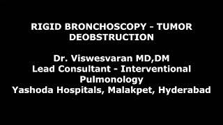 Rigid Bronchoscopic Tumor Debulking  Electrosurgical snaring  Cryoextraction [upl. by Ibson596]