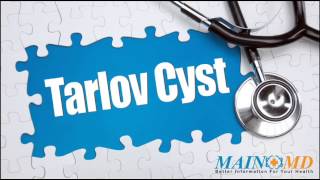 Tarlov Cyst ¦ Treatment and Symptoms [upl. by Raynah553]