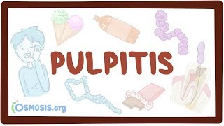 Pulpitis  causes symptoms diagnosis treatment pathology [upl. by Yniar]