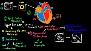 Pathophysiology of Heart Failure 2 [upl. by Anneg]