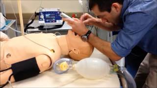 RSI part 3 Intubation [upl. by Gula]