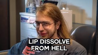 Lip Filler Dissolve Gone Wrong 😱  OKAY REALLY [upl. by Russell527]