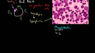 Macrocytic Anemia [upl. by Lindemann]