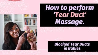 How to perform Tear Duct Crigler Massage for babiesI Doctor explains blocked tear duct [upl. by Ycal312]