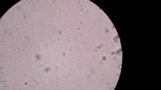 Medical Parasitology Laboratory  Trichomonas vaginalis trophozoite 3 [upl. by Menard]