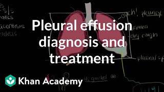 Pleural effusion diagnosis and treatment  Respiratory system diseases  NCLEXRN  Khan Academy [upl. by Bennie456]