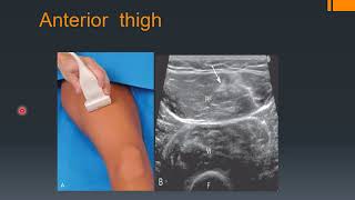 ULTRASOUND ANATOMY OF HIP AND THIGH part1 [upl. by Briny]