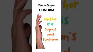 Confirmatory test for Guyon’s canal syndrome Froment’s test Ulnar tunnel syndrome shorts [upl. by Emirac]