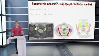 Compartimento Médio  Lateral  Dra Ana Paula Carvalhal [upl. by Atiana]