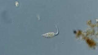 Vicious Single Celled Organism Attacks Another Microscopic Organism [upl. by Elleirad]