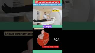 CT coronary angiography l heart coronaryartery shorts [upl. by Romona626]