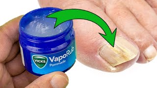 Vicks Vaporub Exposed Unveiling the 12 Hidden Uses and Benefits [upl. by Yorztif]