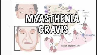 Myasthenia gravis History mrcpch Clinical [upl. by Arihas]