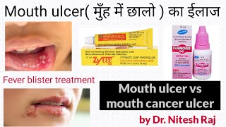 मुँह में छालो का ईलाजFever blister vs Mouth ulcerMouth ulcer vs mouth cancer ulcer by Drniteshraj [upl. by Frederic410]