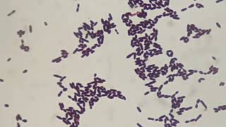 Gram staining of Enterococcus [upl. by Auqenat]