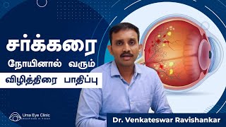 Diabetic Retinopathy amp It’s Treatment  சக்கரை நோயினால் வரும் விழித்திரை பாதிப்பு  Dr Venkatesh [upl. by Barton602]