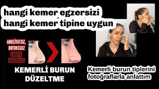 Kemerli Burun Düzeltme Egzersizlerinden Hangisini Uygulayacağını Anlamayanlar Bu Videoya [upl. by Elimay]