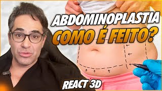 ABDOMINOPLASTIA APÓS A GRAVIDEZ DESCUBRA COMO ESSE PROCEDIMENTO PODE TE AJUDAR [upl. by Fahy497]