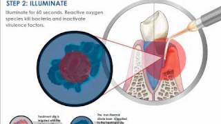 Understanding Photodisinfection [upl. by Leasi968]