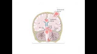 Understanding Kernohans Phenomenon  Central Nervous System  Internal Medicine [upl. by Enelyt]