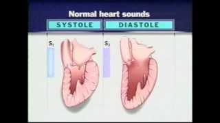 Auscultation of Heart Sounds Part1  Listening to Heart Sounds [upl. by Lundell961]