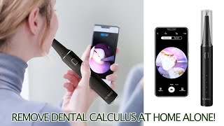 Remove Dental Calculus At Home Alone SUNUO T12 Pro Visual Ultrasonic Dental Scaler  KEPMOV [upl. by Nwahsuq330]