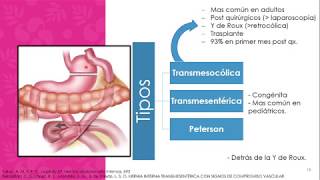 03 Hernias internas [upl. by Ebberta]