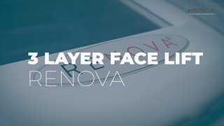 3 LAYER FACE LIFT BY RENOVA [upl. by Slemmer461]