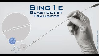 Embryo Transfer  Ultrasound Guided Embryo Transfer During ET  Embryo loading amp transferring [upl. by Elletsirhc]