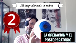 DESPRENDIMIENTO DE RETINA  MI EXPERIENCIA  LA OPERACIÓN Y EL DURO POSTOPERATORIO [upl. by Bohon]