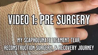 Scapholunate Ligament Tear and Reconstruction  Video 1 PreSurgery [upl. by Warren]