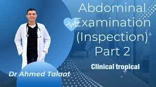 Abdominal examination  inspection part 2Clinical tropicalDr Ahmed Talaat [upl. by Gustafson]