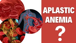 Aplastic anemia Aplastic anemia causes [upl. by Vaughan982]