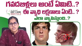 గవదబిళ్లలు అంటే ఏమిటి  Acute Parotitis or Mumps in Telugu  Dr Harika ENT Care Hospital [upl. by Adnim]