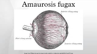 Amaurosis fugax [upl. by Airret829]