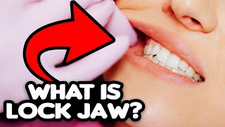 Lock Jaw Explained causes treatment prevention [upl. by Rior795]