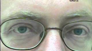 Nystagmus eye movement recording 1 [upl. by Eirellav]