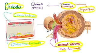 Patofisiologi  Penyakit Ginjal Kronis PGK  Chronic kidney disease CKD [upl. by Keeton]