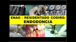 ENAO  RESIDENTADO ODONTOLÓGICO ENDODONCIA [upl. by Lalita]